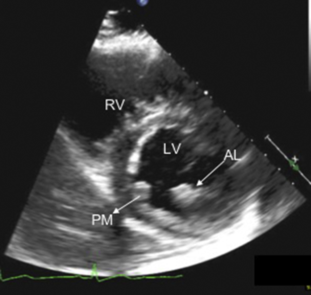 Figure 4