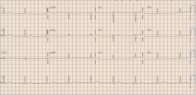 Figure 2