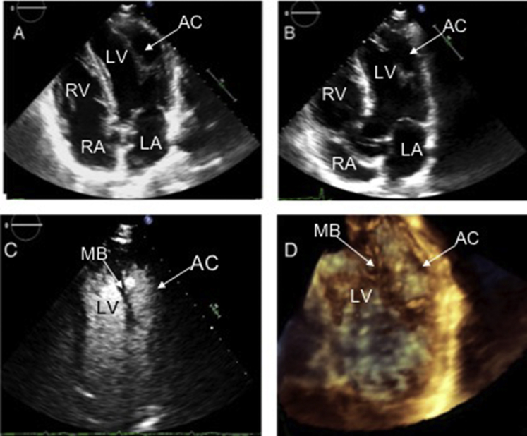 Figure 3