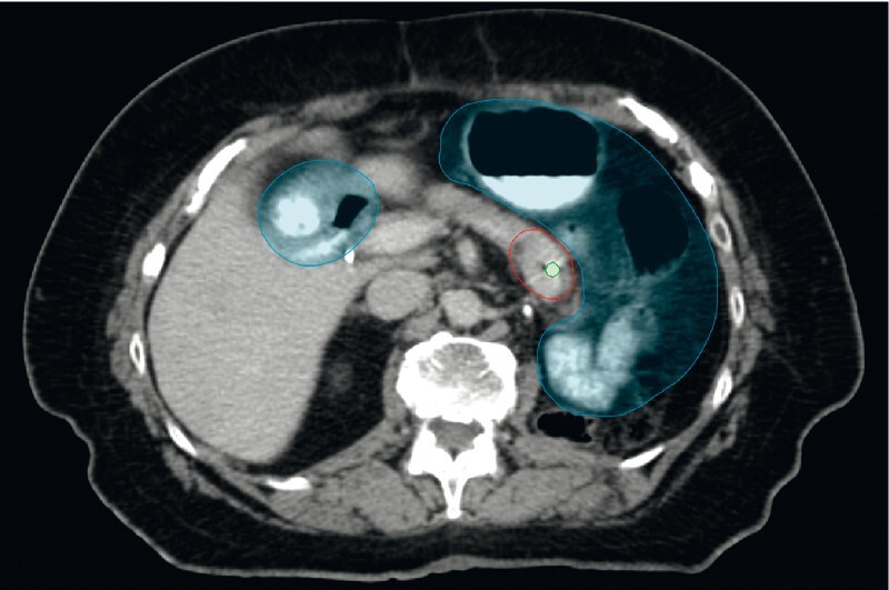 Fig. 3