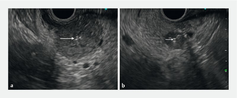 Fig. 2