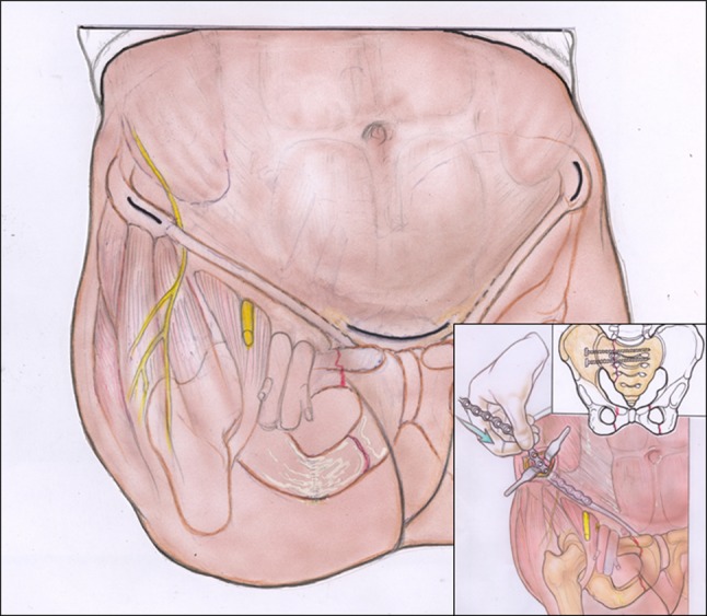 Fig. 2