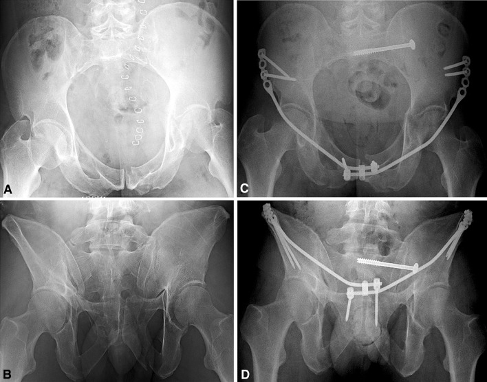 Fig. 7A–D