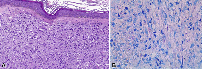 Fig 2