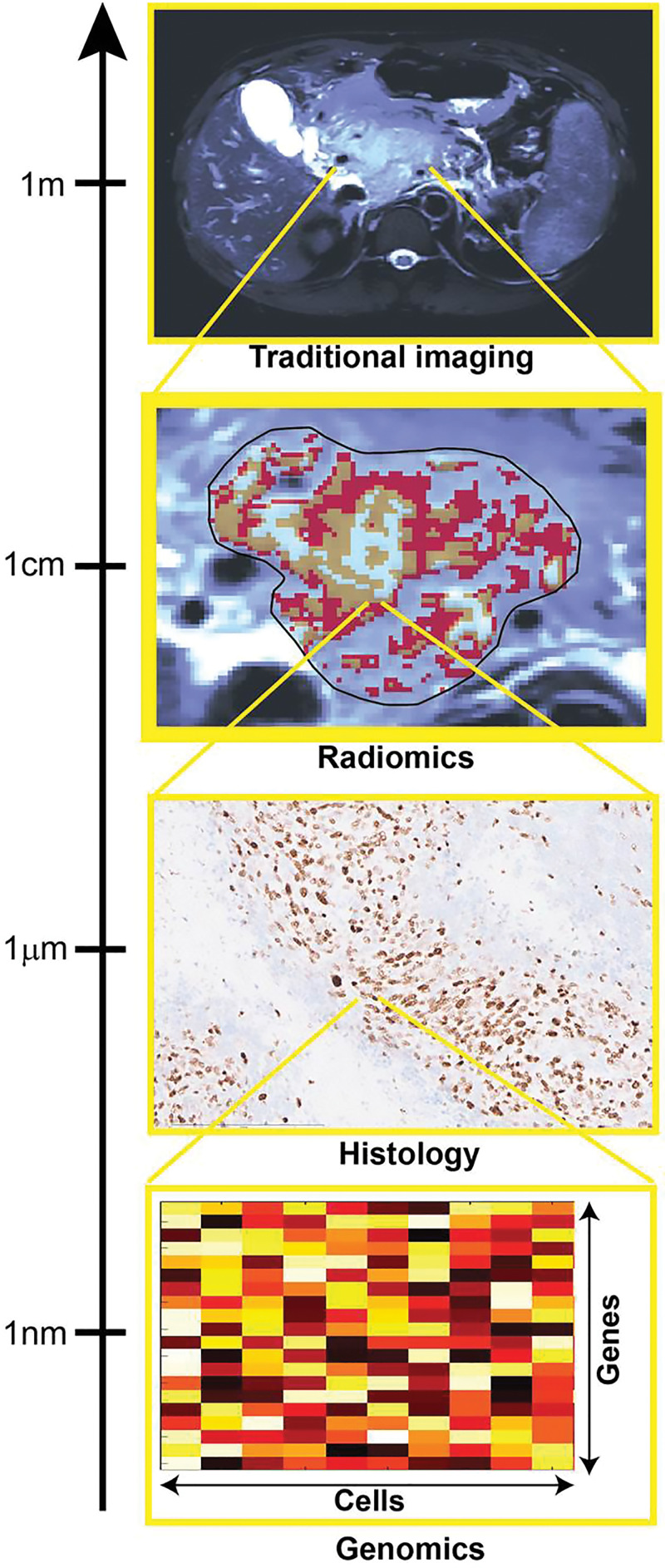 Image shows how multiscale quantification provides complementary tumor insight. Histologic and genomic analysis can provide specific small-scale insight useful for validation of radiomic results, focused on quantification of spatial patterns of size exceeding image resolution.