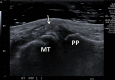 Figure 13a.