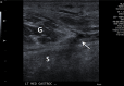 Figure 9a.
