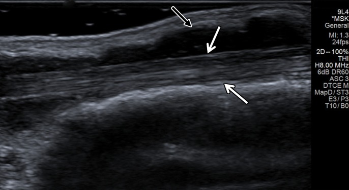 Figure 7a.