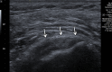 Figure 5a.