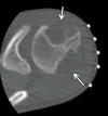 Figure 19b.