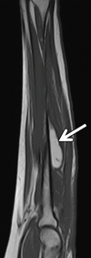 Figure 14a.