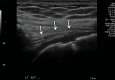 Figure 6a.
