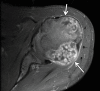 Figure 19a.