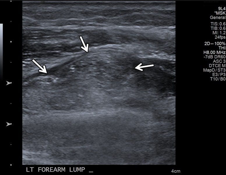 Figure 14b.