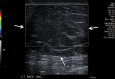 Figure 15a.
