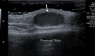 Figure 17a.