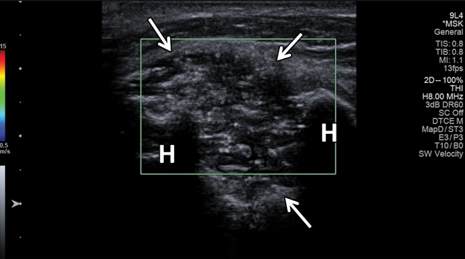 Figure 19c.