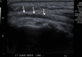 Figure 10a.