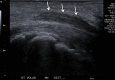 Figure 11a.