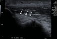 Figure 12a.