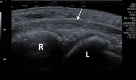 Figure 2a.