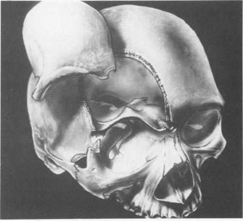 FIG. 3C.