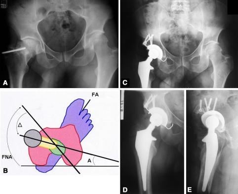 Fig. 2A–E