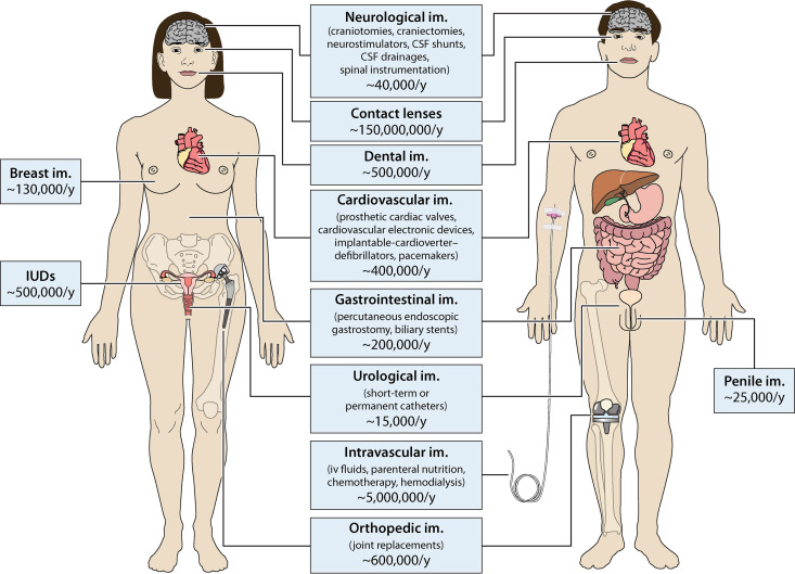 FIG 1