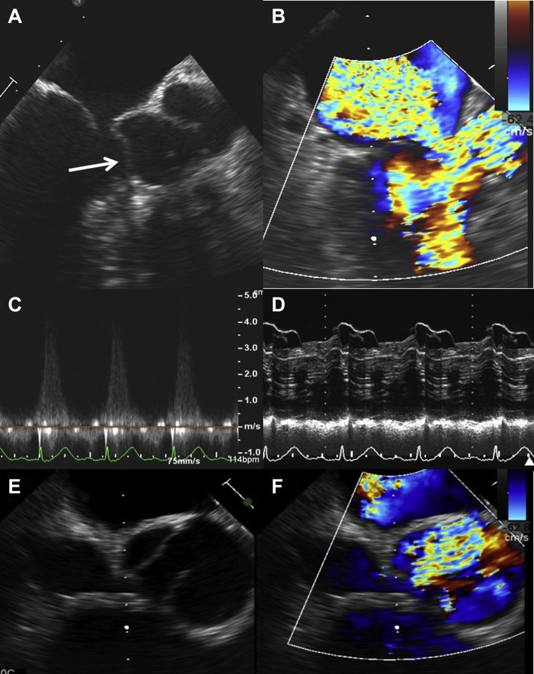 Figure 2