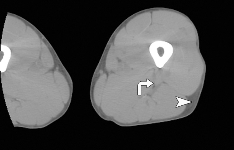 Figure 1d: