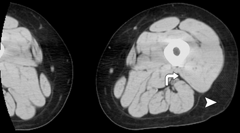 Figure 1b: