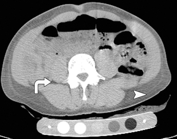 Figure 1c: