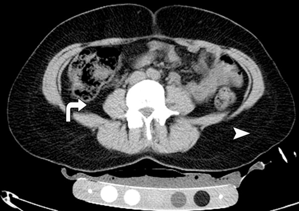 Figure 1a: