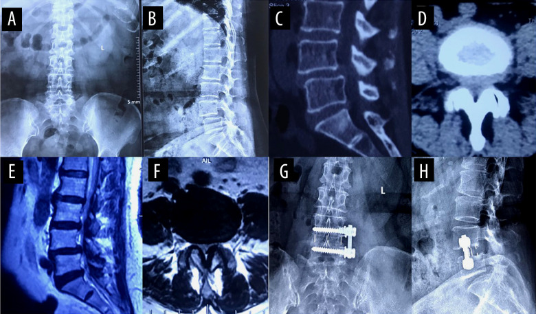 Figure 5