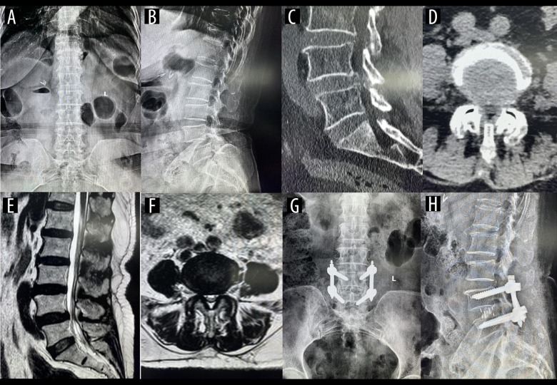 Figure 6