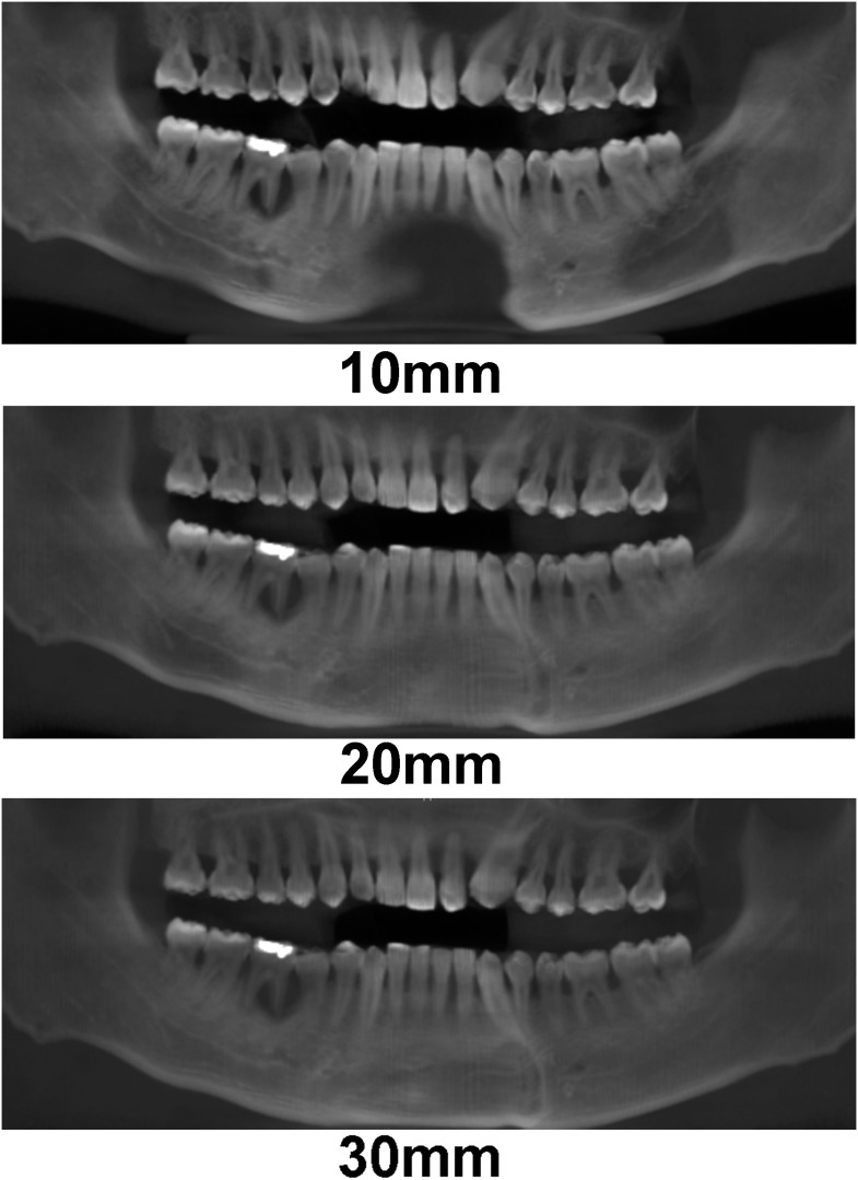 Figure 23