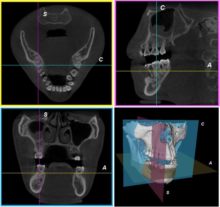 Figure 17