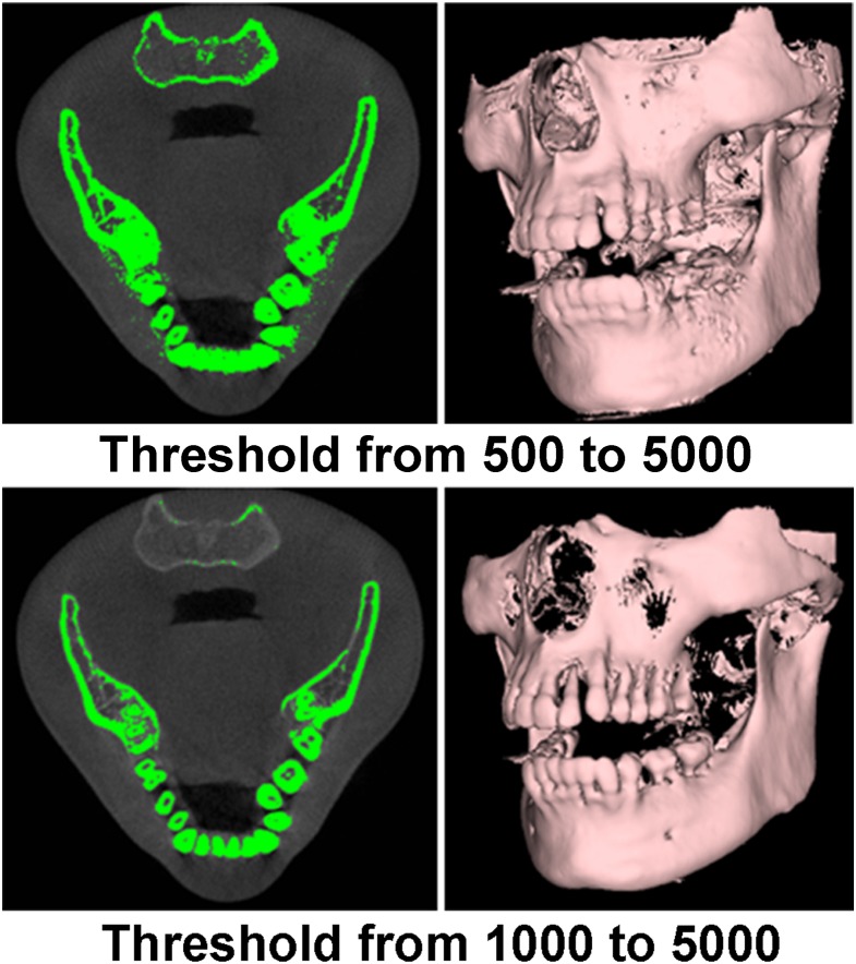 Figure 25