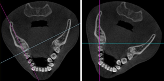 Figure 19