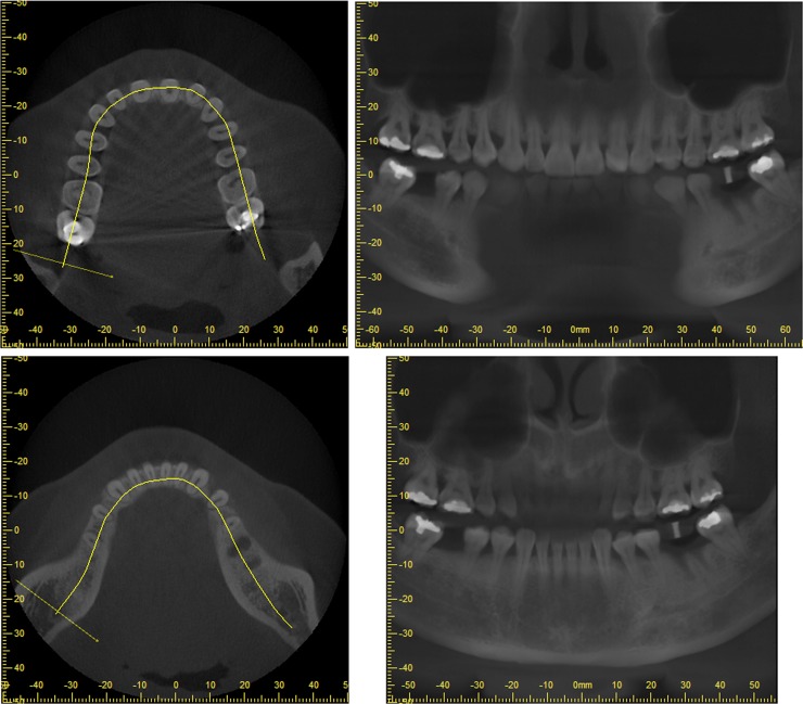 Figure 22