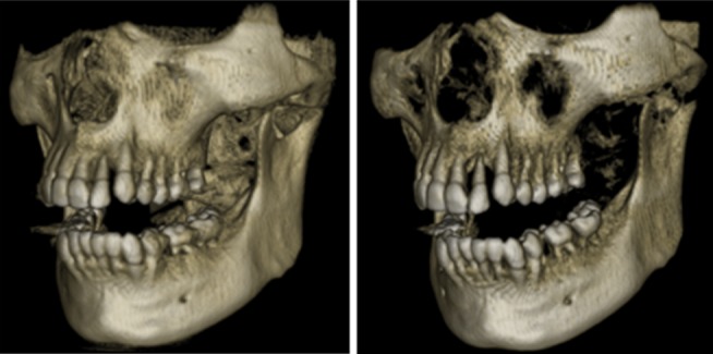 Figure 26