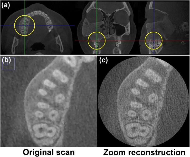 Figure 33