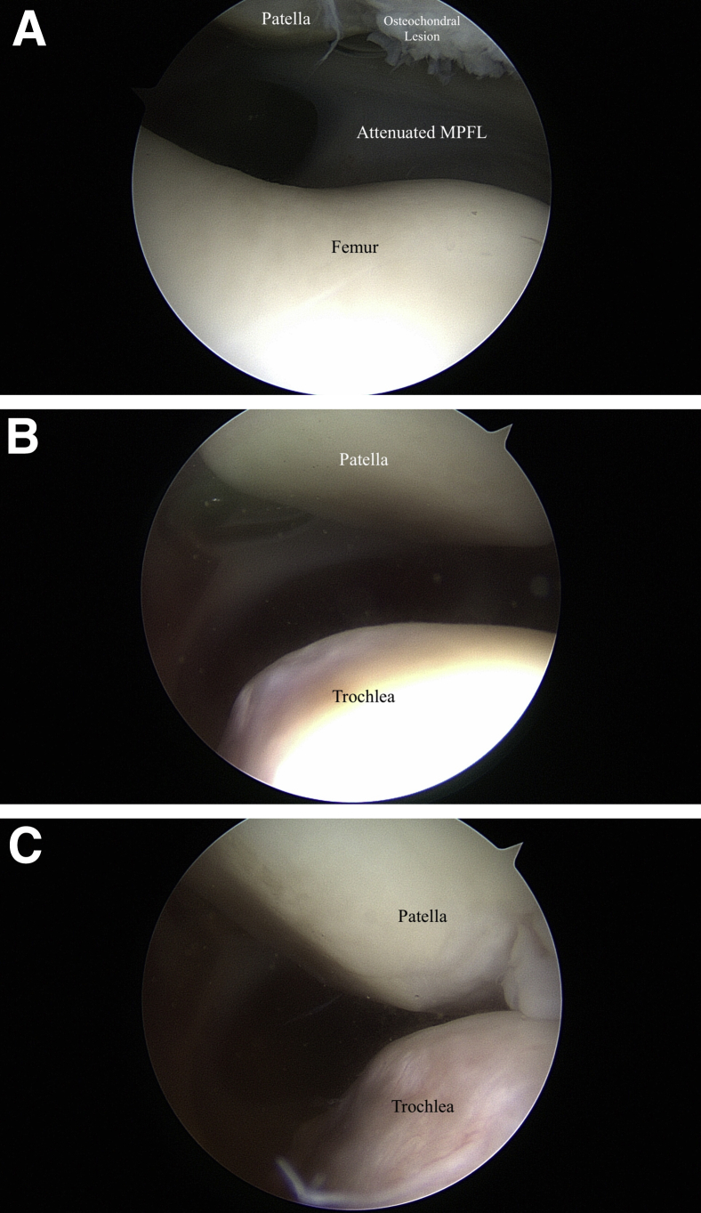 Fig 4