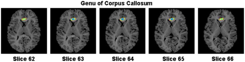 Fig. 13