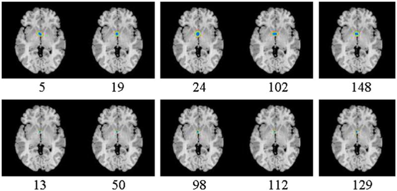 Fig. 16