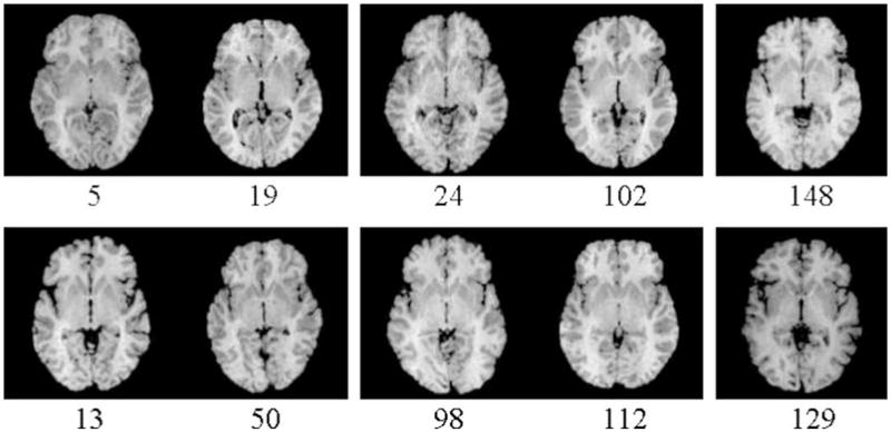 Fig. 16