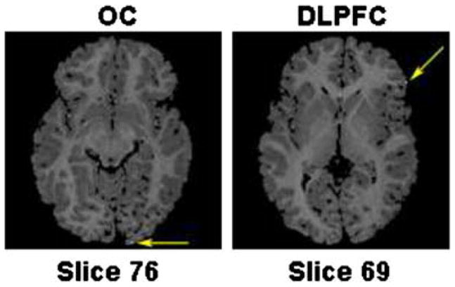 Fig. 15