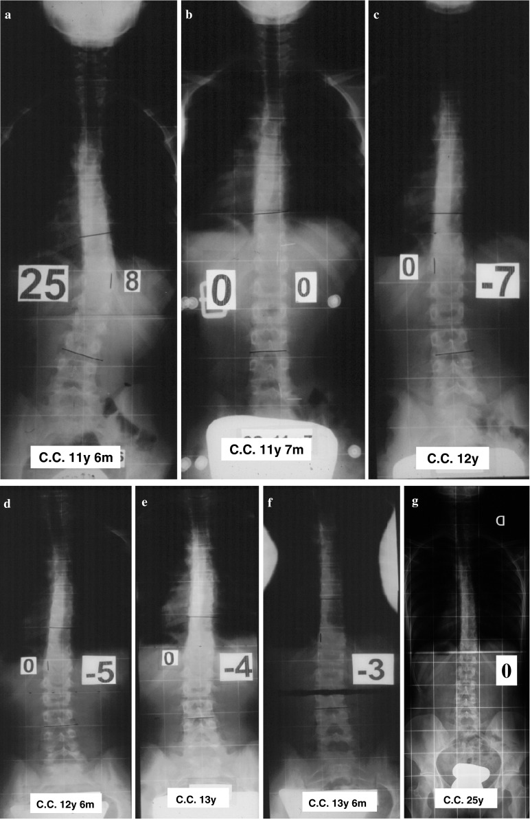 Fig. 4