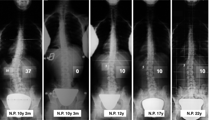 Fig. 1