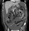 Fig. 2